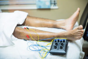 electro acupuncture